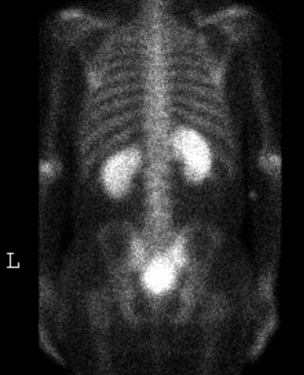 kidney2.gif
