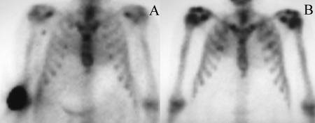 Lymph Node